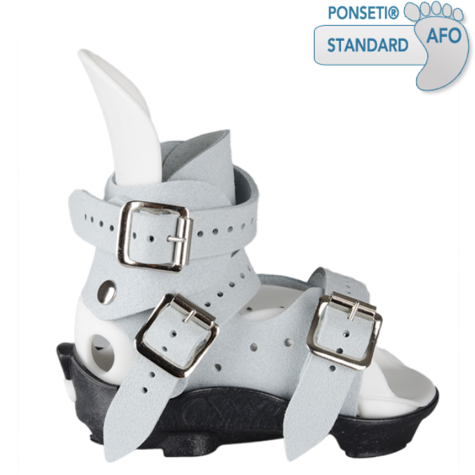 Clubfoot AFO MD Orthopaedics Clubfoot/Ponseti
